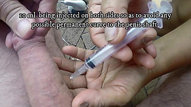 Injection  gives a rock-hard erection